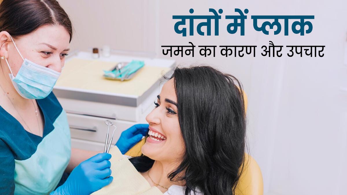 दांतों में प्लाक (पीली परत) जमने के हो सकते हैं ये कारण, डॉक्टर से जानें क्या है इसका इलाज