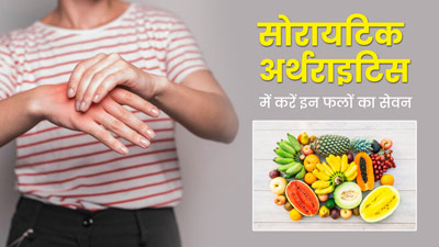 सोरायटिक अर्थराइटिस में फायदेमंद है इन 5 फलों का सेवन, कई समस्याएं होती हैं कम