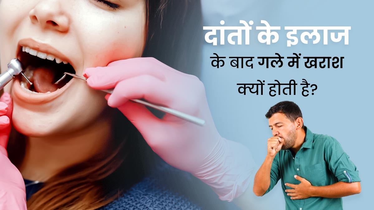 दांतों के इलाज के बाद गले में खराश क्यों होती है? डॉक्टर से जानें इसके कारण