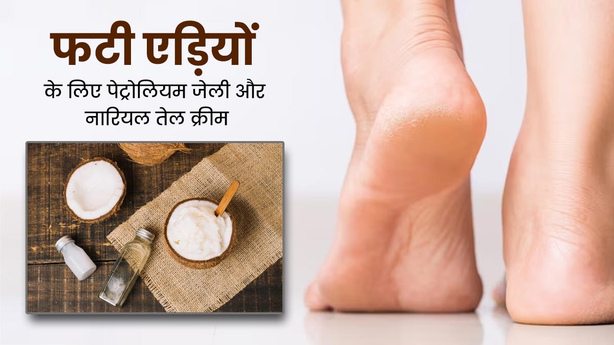सर्दियों में एड़ियों पर लगाएं पेट्रोलियम जेली और नारियल तेल से बनी क्रीम, फटी एड़ियों से मिलेगा छुटकारा