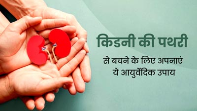 किडनी की पथरी से बचने के लिए अपनाएं ये 5 आयुर्वेदिक उपाय