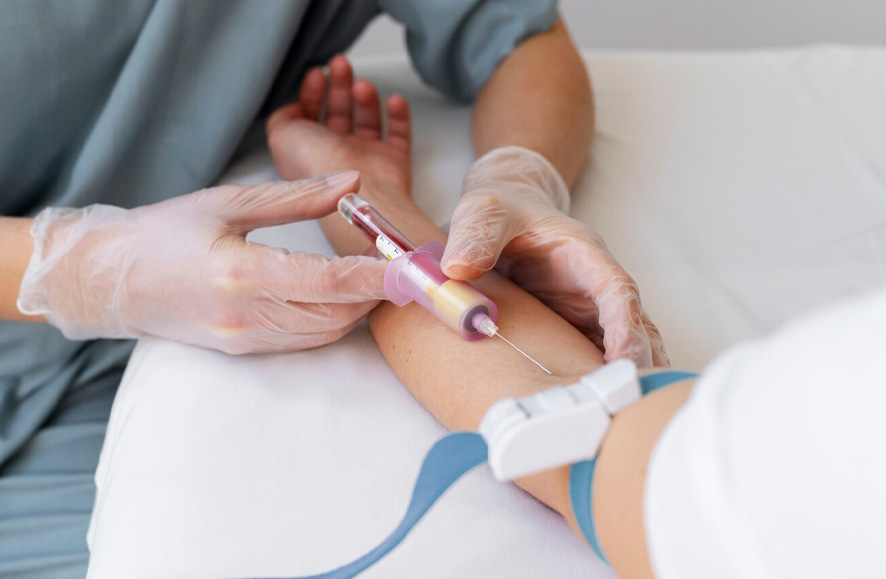 Are Blood Tests Necessary