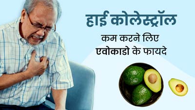 हाई कोलेस्ट्रॉल कम करने लिए रामबाण है एवोकाडो, जानें कैसे करें इस्तेमाल