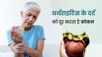 अर्थराइटिस रोगी जरूर करें कोकम फल का सेवन, दर्द और सूजन से मिलेगा आराम 