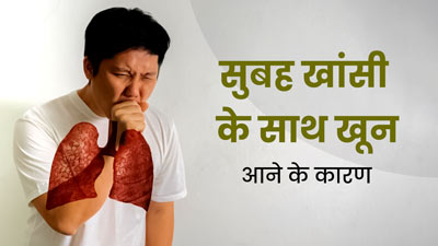 सुबह खांसी के साथ खून आने को भूलकर भी न करें नजरअंदाज, जानें कारण और बचाव