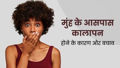 मुंह के आसपास कालापन क्यों हो जाता है? जानें कारण और बचाव के उपाय