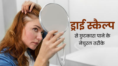 ड्राई स्कैल्प की वजह से सिर में हो रही है खुजली, तो आजमाएं ये 5 नेचुरल तरीके, मिलेगा आराम