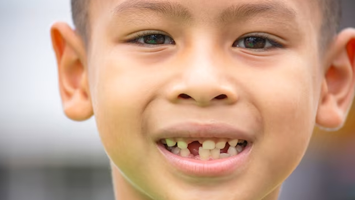 Is It Bad To Pull Out Baby’s Loose teeth In Hindi