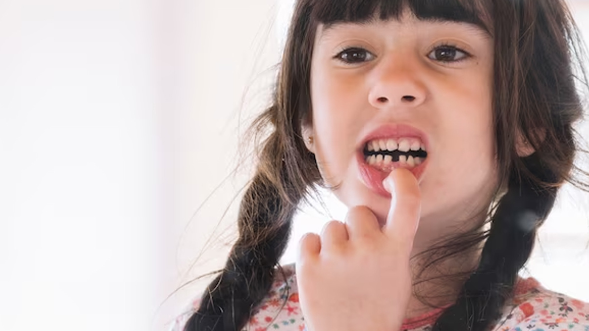 How To Pull Out A Loose Tooth Without Pain In Hindi