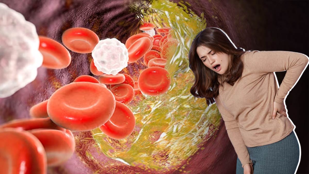 High Cholesterol: कोलेस्ट्रॉल बढ़ने पर शरीर के इन 5 हिस्सों में हो सकता है दर्द, न करें अनदेखा