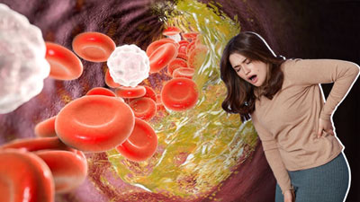 High Cholesterol: कोलेस्ट्रॉल बढ़ने पर शरीर के इन 5 हिस्सों में हो सकता है दर्द, न करें अनदेखा