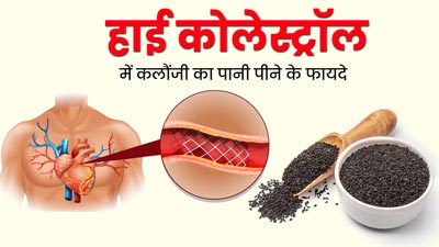 हाई कोलेस्ट्रॉल कम करने के लिए पिएं कलौंजी का पानी, जल्दी मिलेगा फायदा