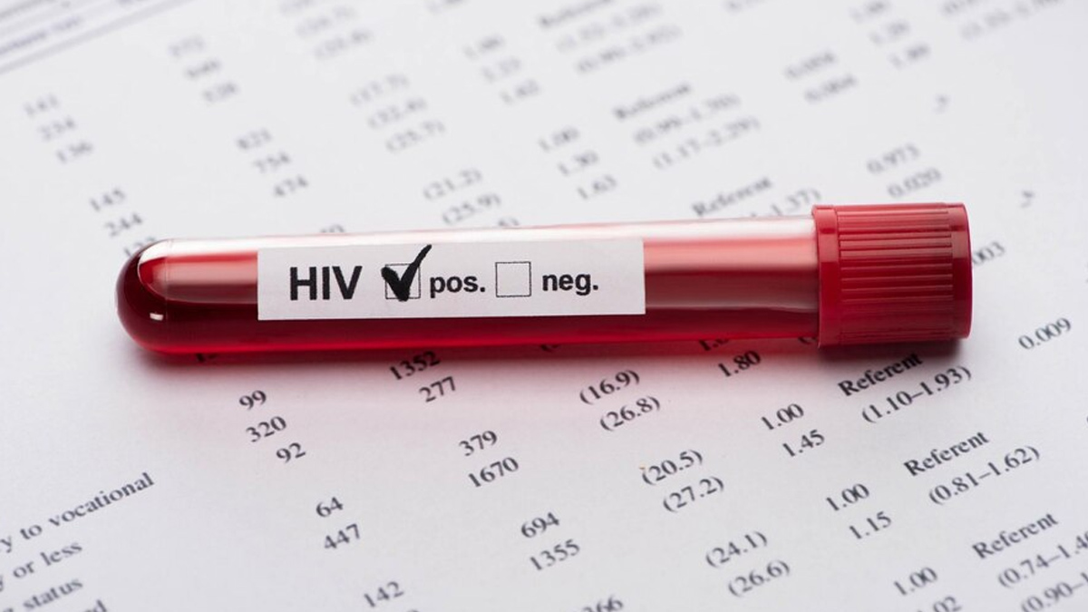 testing of HIV