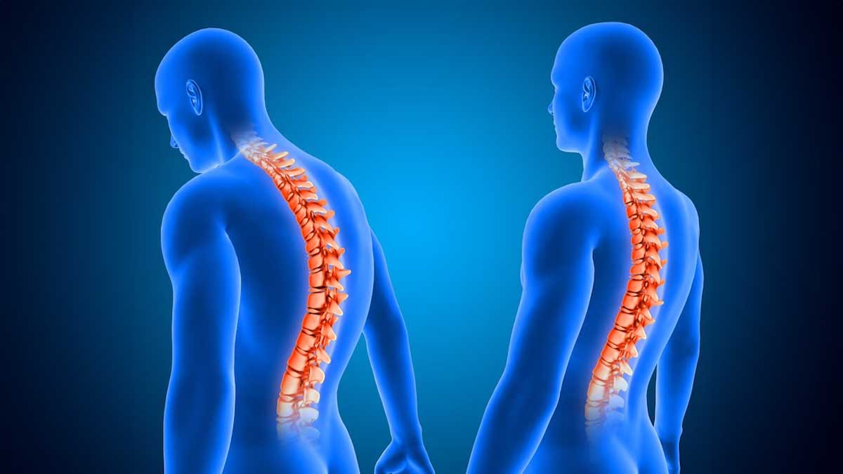 Ankylosing Spondylosis Bigg Boss 17 Khanzaadi