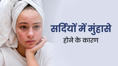 सर्दियों में एक्ने की समस्या क्यों बढ़ जाती है? जानें इसके कारण