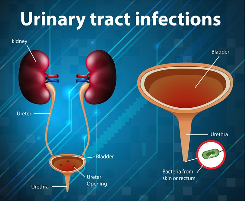 Blood Clots In Urine: Expert Lists Its Causes, Complications, And The  Danger Signs