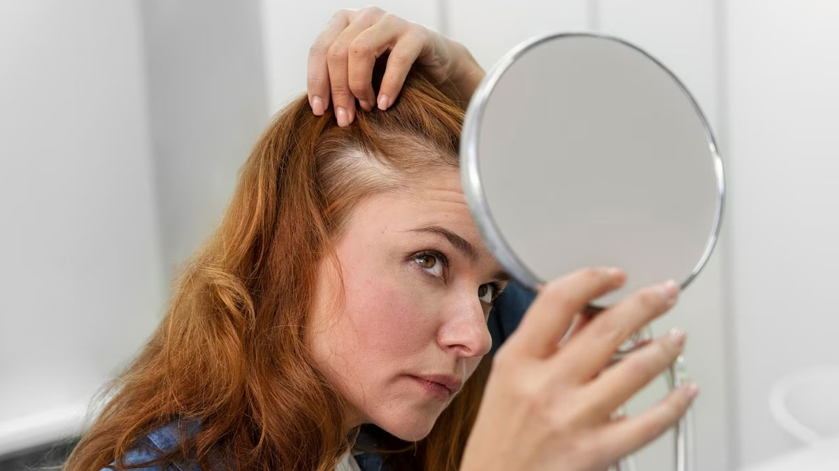 Suffering From Hair Loss? DIY Amla Hair Mask For Strong Hair