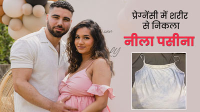 प्रेग्नेंसी में 24 वर्षीय इस मह‍िला के शरीर से न‍िकला 'नीला पसीना', डॉक्‍टर से जानें इस दुर्लभ कंडीशन का कारण 