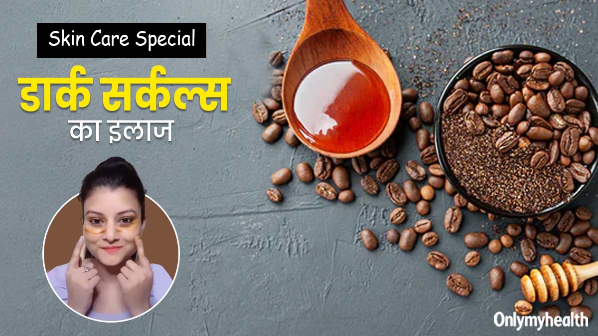 डार्क सर्कल्स को दूर करने के ल‍िए गीत ने ट्राई क‍िया यह घरेलू नुस्‍खा, हफ्ते भर में दिखने लगा असर 