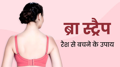 ब्रा के स्ट्रैप से छिल गई है त्वचा, तो छुटकारा पाने के लिए अपनाएं ये 4 उपाय