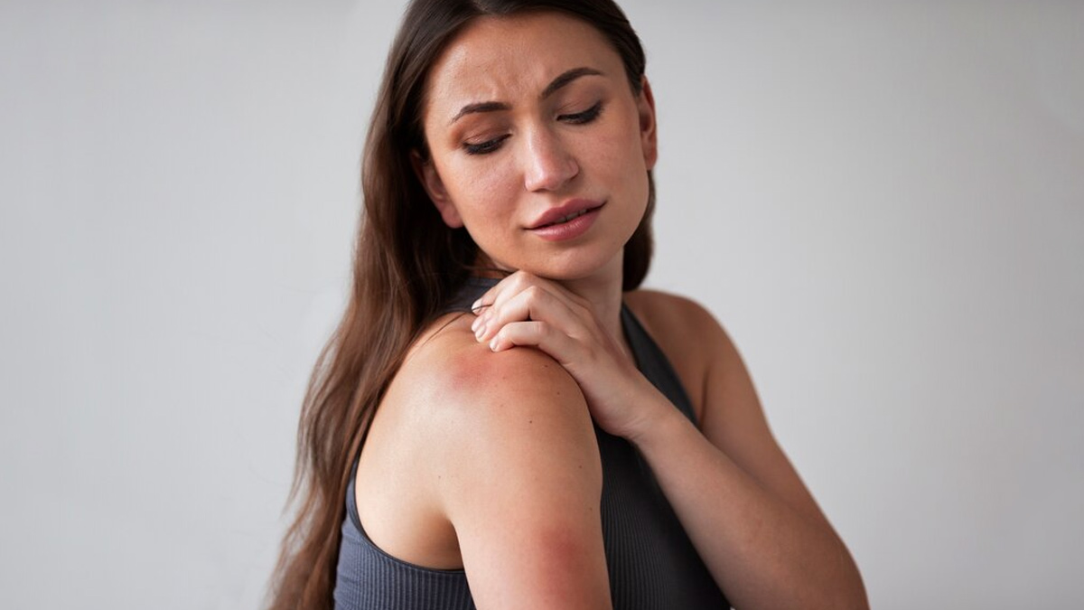 skin infection