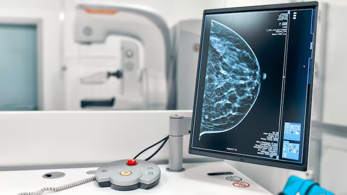 Breast Cancer Comeback
