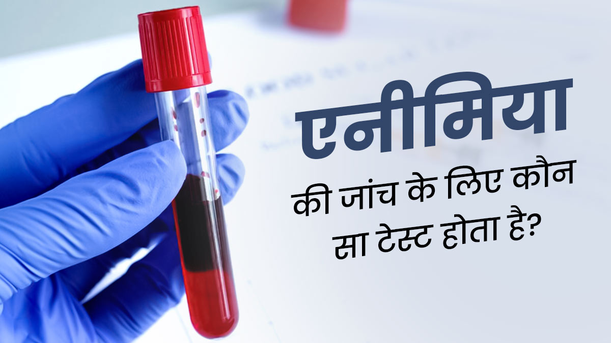 एनीमिया की जांच के लिए कौन सा टेस्ट होता है? जानें इसके बारे में