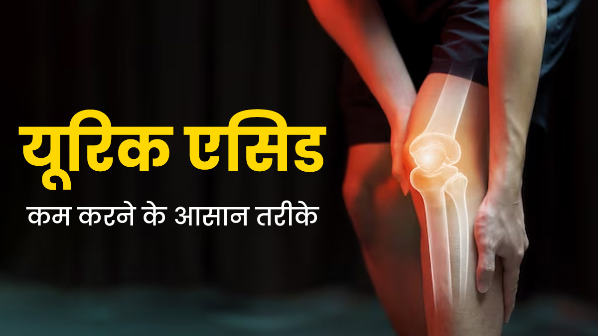 यूरिक एसिड बढ़ने के कारण परेशान कर रहा है जोड़ों का दर्द? एक्सपर्ट से जानें इसे कम करने के 3 तरीके
