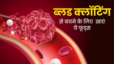 ब्लड क्लॉट होने से बचाने के लिए करें इन फूड्स का सेवन, जानें एक्सपर्ट से