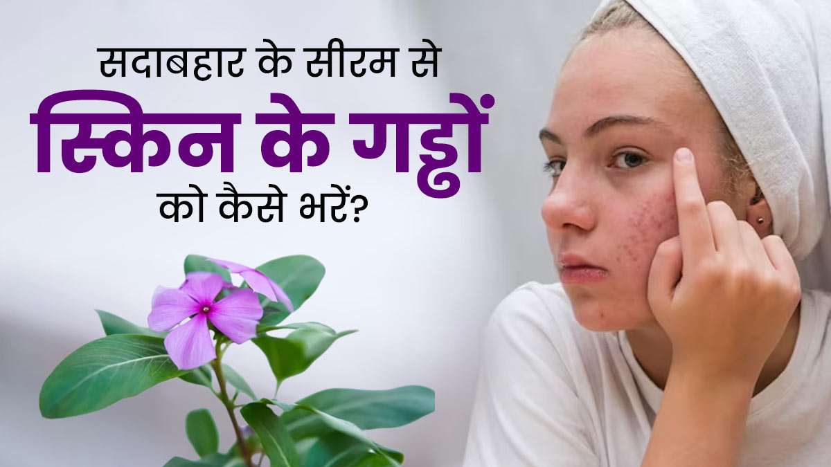 सदाबहार के फूलों से घर पर बनाएं फेस सीरम, ओपन पोर्स को बंद करने में मिलेगी मदद