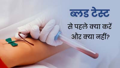 ब्‍लड टेस्‍ट कराने से पहले क‍िन बातों का ख्‍याल रखना चाह‍िए? डॉक्‍टर से जानें क्‍या करें और क्‍या नहीं 