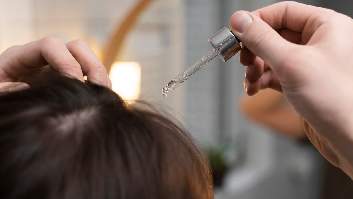 Can Oiling Your Hair Reduce Dandruff: Expert Explains If Its A Myth or ...