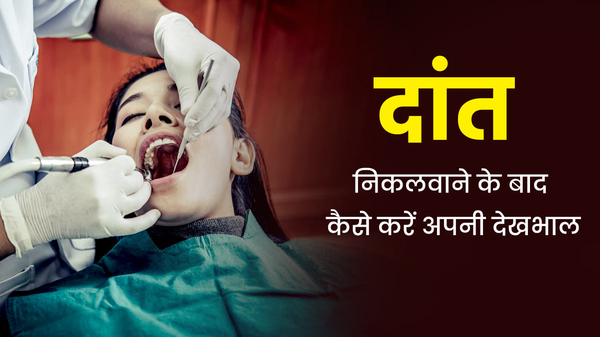 दांत निकलवाने के बाद इन 4 तरीकों से करें अपनी देखभाल, दर्द से मिलेगा छुटकारा