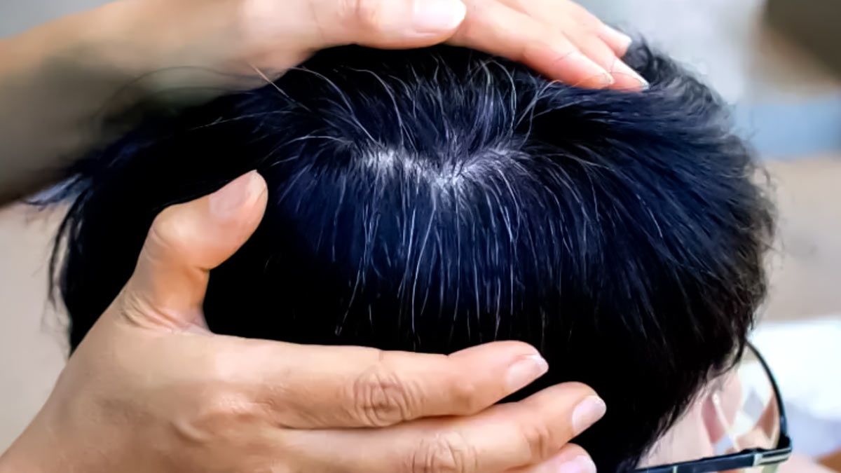 सफेद हो रहे हैं बच्‍चे के बाल? डॉक्‍टर से जानें क्या है इसका इलाज