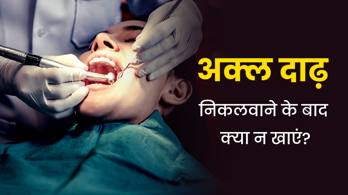 अक्ल दाढ़ निकलवाने के बाद न खाएं ये 5 चीजें, रिकवरी में मिलेगी मदद