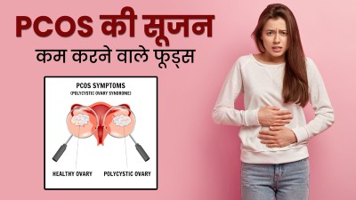 महिलाओं में PCOS के कारण होने वाली सूजन दूर करते हैं ये 5 फूड्स, जरूर करें डाइट में शामिल