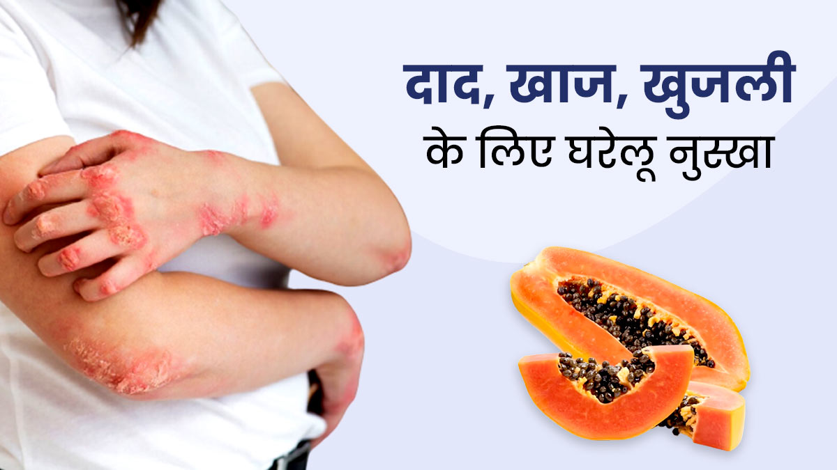 दाद, खाज और खुजली की समस्या से छुटकारा दिलाएगा पपीता, एक्सपर्ट से जानें इस्तेमाल का तरीका