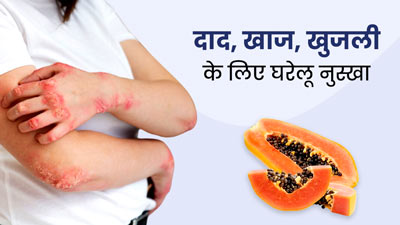दाद, खाज और खुजली की समस्या से छुटकारा दिलाएगा पपीता, एक्सपर्ट से जानें इस्तेमाल का तरीका