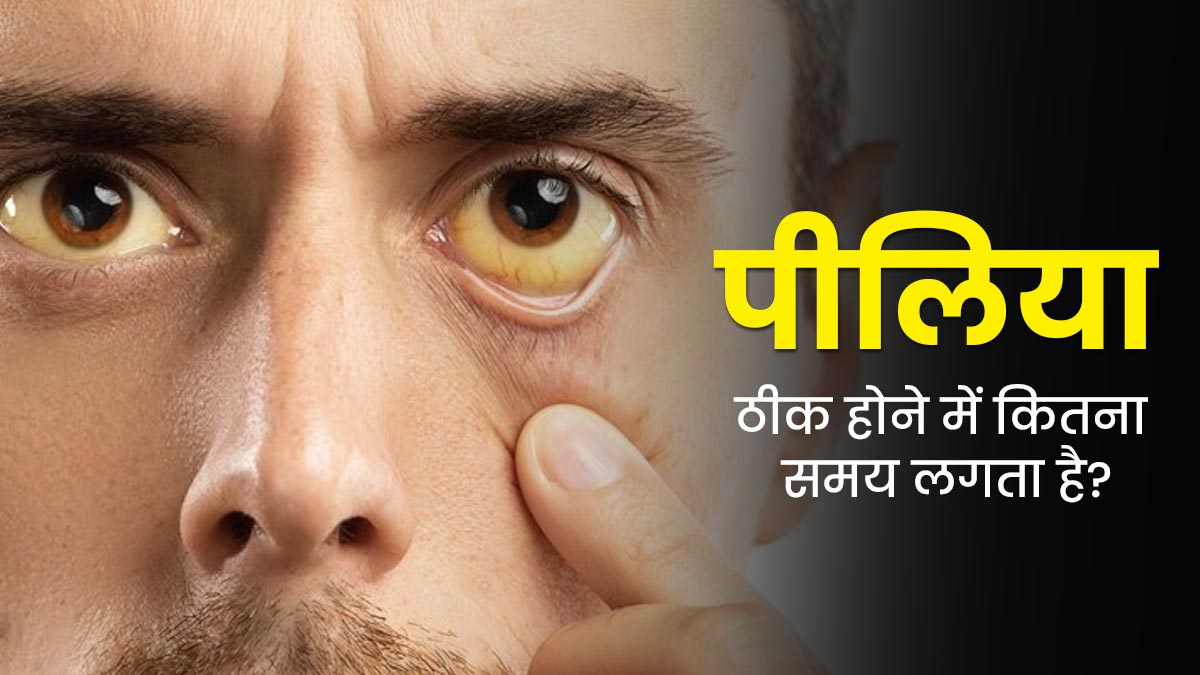 पीलिया (जॉन्डिस) ठीक होने में कितना समय लगता है? जानें डॉक्टर से