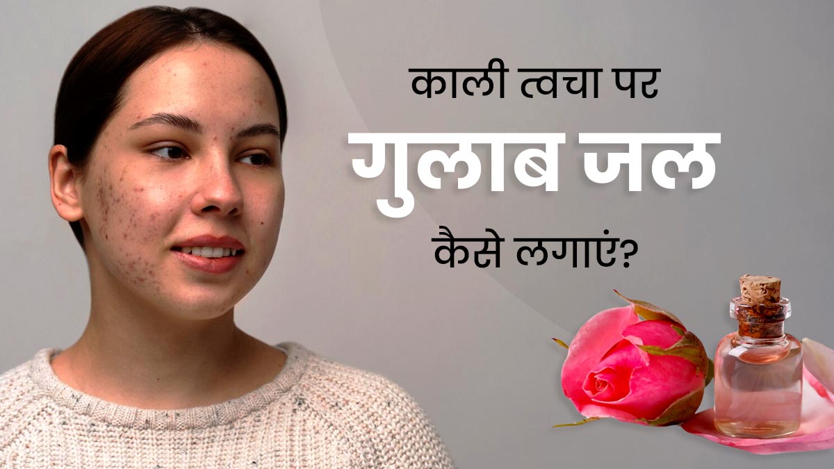 धूप में काली पड़ गई है त्वचा, तो इन 4 तरीकों से करें गुलाब जल का इस्तेमाल