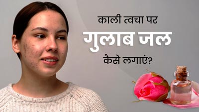 धूप में काली पड़ गई है त्वचा, तो इन 4 तरीकों से करें गुलाब जल का इस्तेमाल