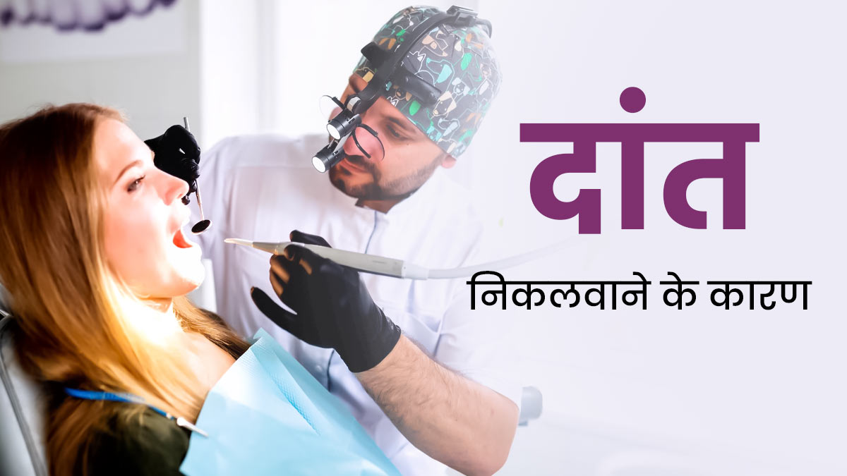 इन 4 स्थितियों में निकलवाना पड़ सकता है दांत, जानकर आप भी हो जाएं अलर्ट 