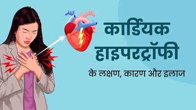 कार्डियक हाइपरट्रॉफी क्या है? डॉक्टर से जानें इसके लक्षण, कारण और इलाज