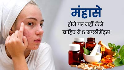 क्या आपकी त्वचा पर भी रहते हैं मुंहासे? तो ये 5 सप्लीमेंट्स लेने से और भी अधिक बढ़ सकते हैं मुंहासे