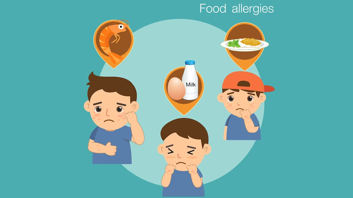 food-allergies