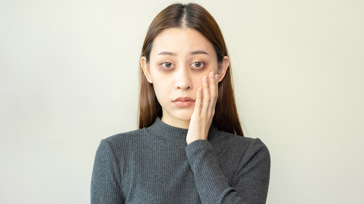 Dealing With Pesky Dark Circles? Here Are Some Vitamin Deficiencies You Should Consider