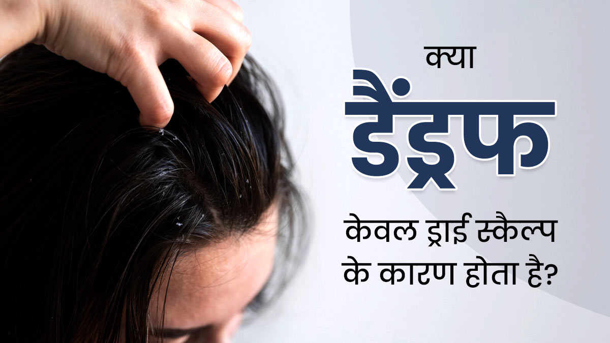 क्या सिर्फ ड्राई स्कैल्प पर ही डैंड्रफ की समस्या होती है? एक्सपर्ट से जानें