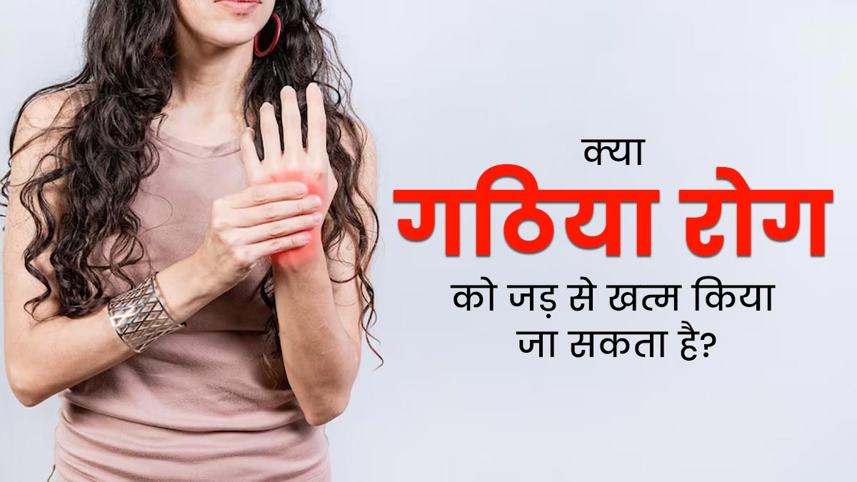 क्या गठिया रोग को जड़ से खत्म किया जा सकता है? जानें क्या कहते हैं डॉक्टर्स