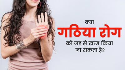 क्या गठिया रोग को जड़ से खत्म किया जा सकता है? जानें क्या कहते हैं डॉक्टर्स