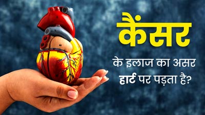 क्‍या कैंसर के इलाज का असर हार्ट पर पड़ता है? डॉक्‍टर से जानें 